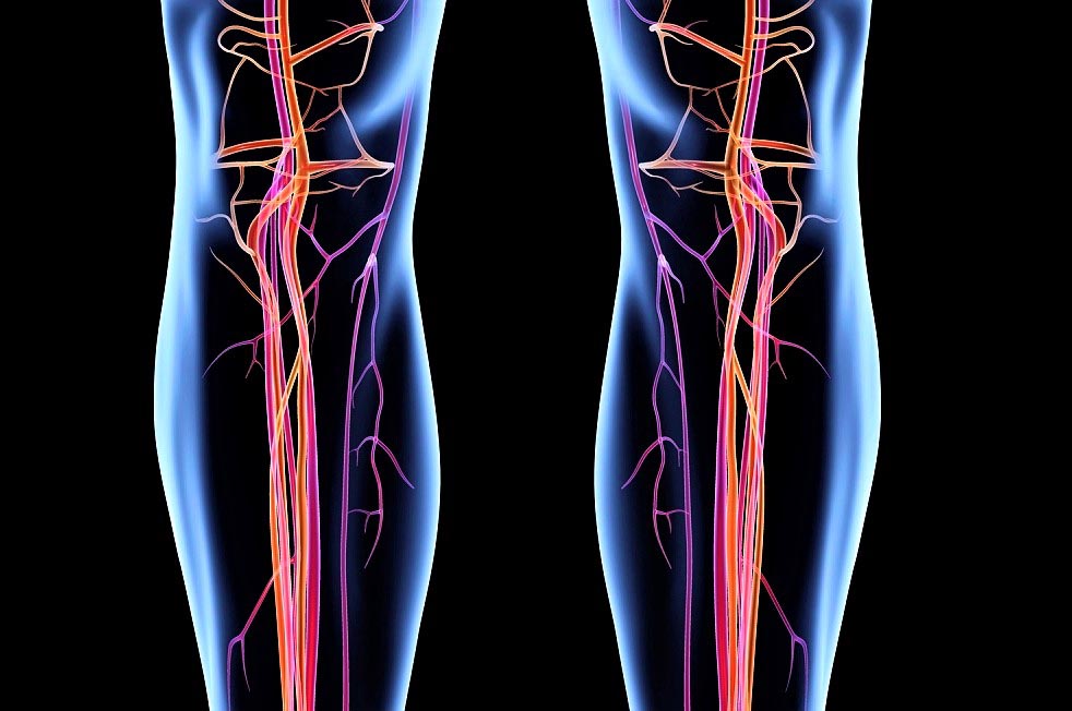 Ангиография артерий нижних конечностей