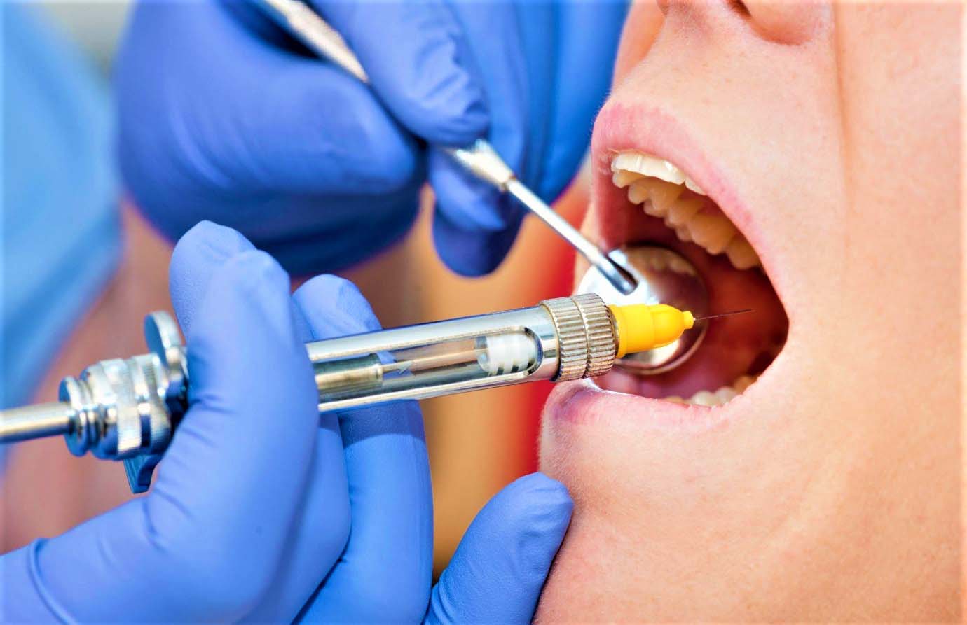 Инфильтрационная анестезия зуба