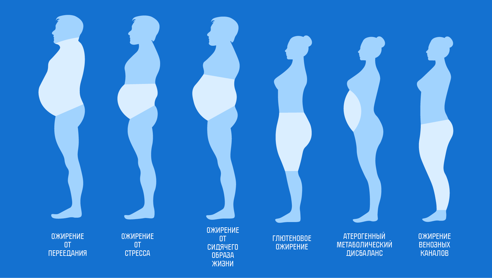 Типы ожирения. Разные формы живота. Типы женских животиков. Гормональный живот. Насколько плотно